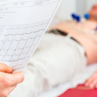 Analiza zapisu EKG u pacjenta.