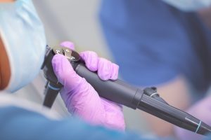Kolonoskopia w pełnym znieczuleniu Gdańsk