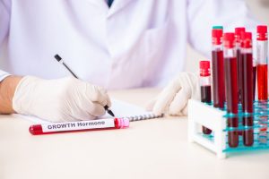 Przyczyną akromegalii jest przede wszystkim wzmożone wydzielanie hormonu wzrostu.
