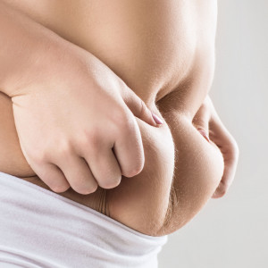 Abdominoplastyka (wycinanie nadmiaru fałdów skórnych z tkanka tłuszczową)