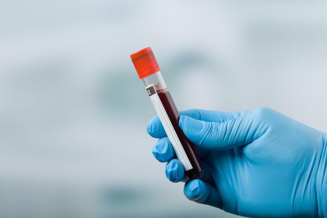 Probówka zawierająca krew przeznaczona do badań laboratoryjnych.