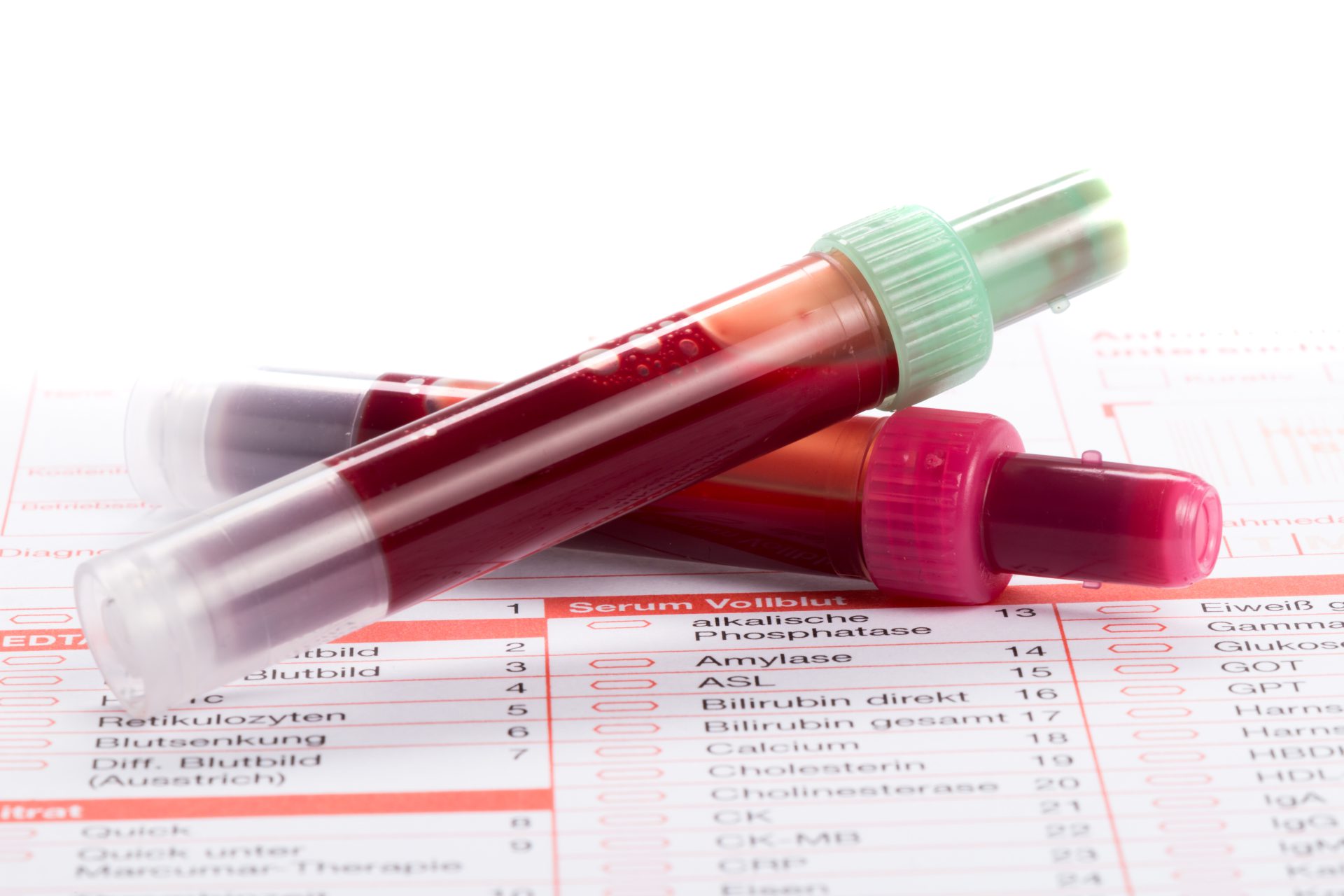 Fiolki zawierające krew przeznaczoną do analizy laboratoryjnej.