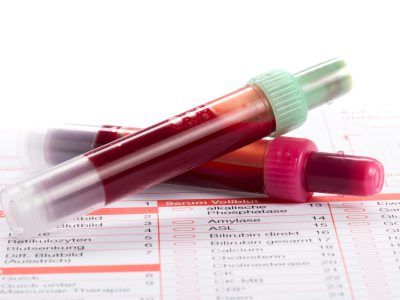 Fiolki zawierające krew przeznaczoną do analizy laboratoryjnej.