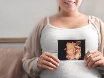 Kobieta w zaawansowanej ciąży trzymająca wydruk z badania usg