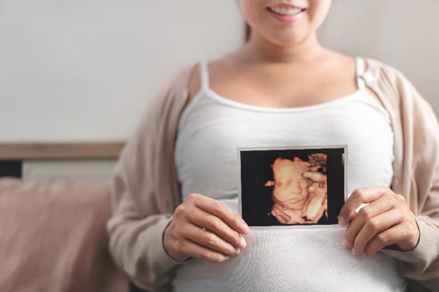 Czy warto zrobić USG 4D w ciąży?