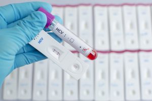 Test wykrywający wirusa hcv