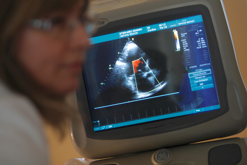 ECHO serca -Kardiolog z Centrum Kardiologicznego ETERMED w Gdańsku bada pacjenta za pomocą ultrasonografu