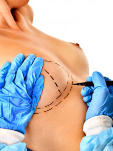 Operacja powiększenia piersi w szpitalu 1DayClinic w Gdańsku